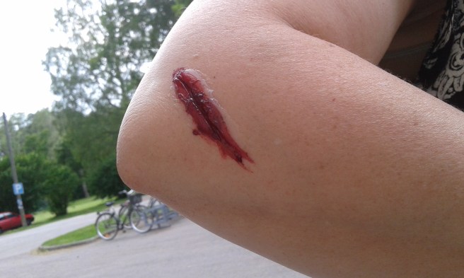 Det här borde kanske plåstras om?